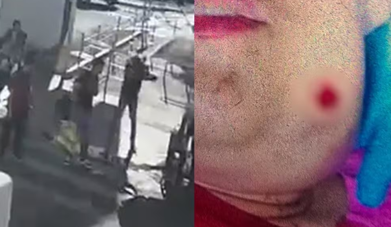 jovem autista baleada em goiânia