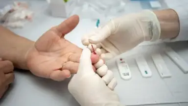 Aumento de infecções por HIV acende alerta; veja como SUS oferece prevenção e tratamento